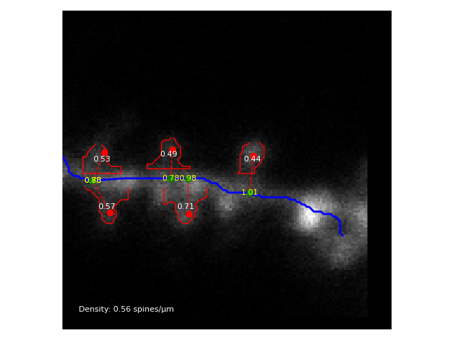 Dendritic Spine Analysis